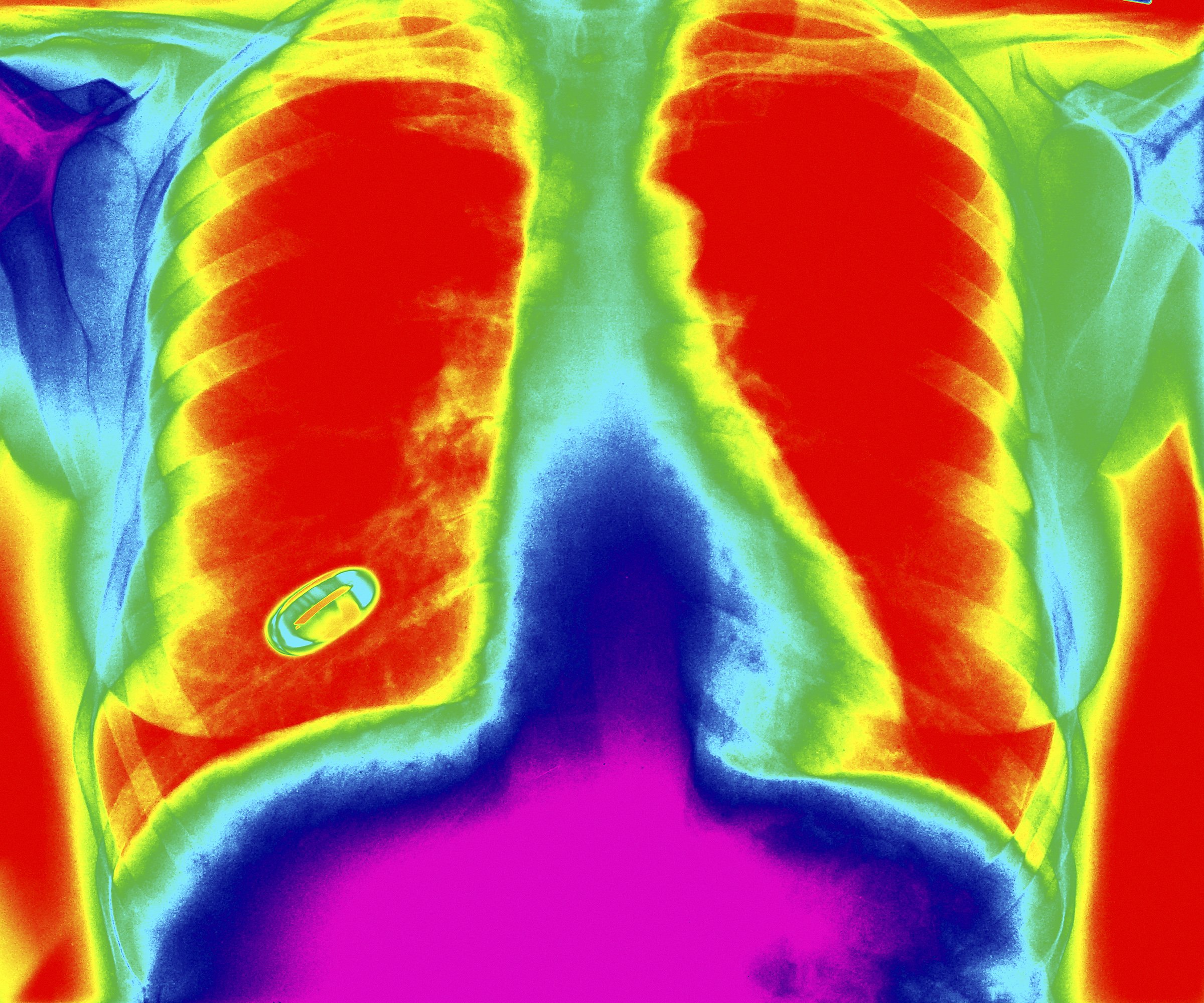 Go out into the streets of Copenhagen with everyone else in the city. While you're at it get your lungs checked out
