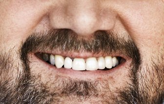 RÆVEN - Studenterorganisationer beskylder deres minister for at fuske med tallene, stort set hver gang, hans ministerium offentliggør en analyse. Denne gang får de studerende bred opbakning fra politikere og erhvervsforskere. 