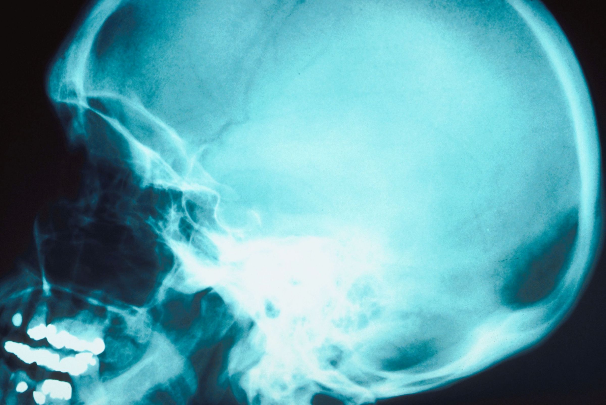 BRAINS! - Giv os hjerner! På fredag afholder Life en akademiseret version af caféernes Trivial Pursuit-turneringer. Rigtige studerende tørner sammen om rigtig forskning. Med øl.