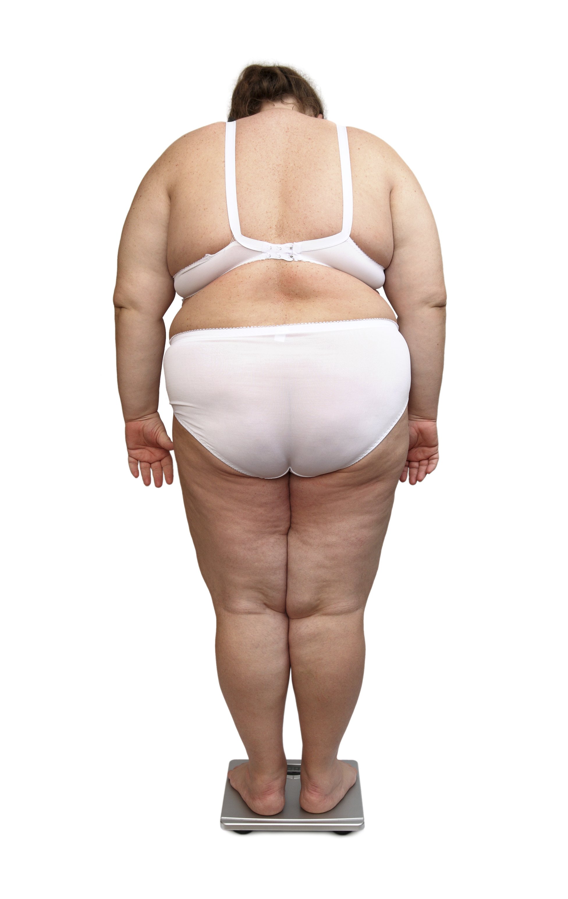 An obesity discoursed based on averages and the statistically constructed concept of ‘ideal weight’ have led to the pathologisation of underweight and obesity, says social historian Ulrike Thoms