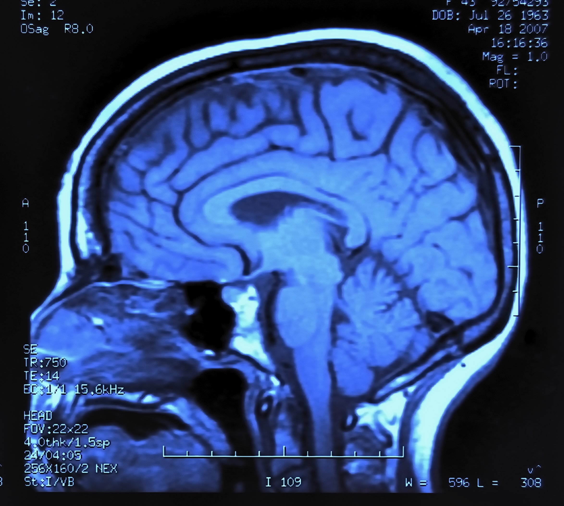 Students improve their brain power with prescription drugs. Universities should run drug tests, warns neurologist.