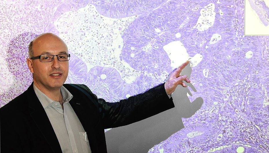 Digital mikroskopi gør det muligt at vise forstørrelser af væv på en storskærm i klasselokalet, og de studerende kan altid selv hente billederne ned fra internettet til deres computer, fortæller klinisk professor Ben Vainer. 