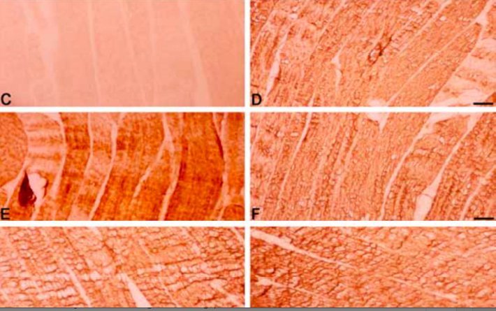 SNIT - De to øverste felter til højre forestiller ifølge artiklen, som Milena Penkowa og Bente Klarlund er medforfattere på, to forskellige muskelprøver i tværsnit. Men forskyder man det ene snit en smule i forhold til det andet, ses det, at der kun er tale om én prøve. Det var ifølge UVVU groft uagtsomt af Klarlund, som var 'ledende forfatter' at overse dette, selv om det var Milena Penkowa, der lavede snittene.