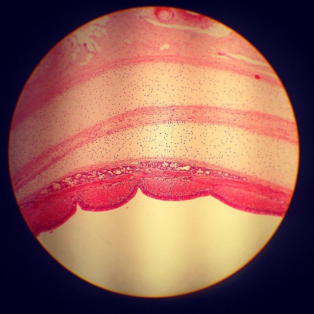 Look closer! Instagram user kustudieliv shared this stunning image of a cross-cut bronchus (an airway in the respiratory tract) under a microscope at the Department of Molecular Biology. 
