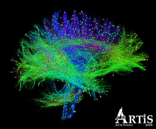 Culture Night Visitors Choice - Pathways in the human brain