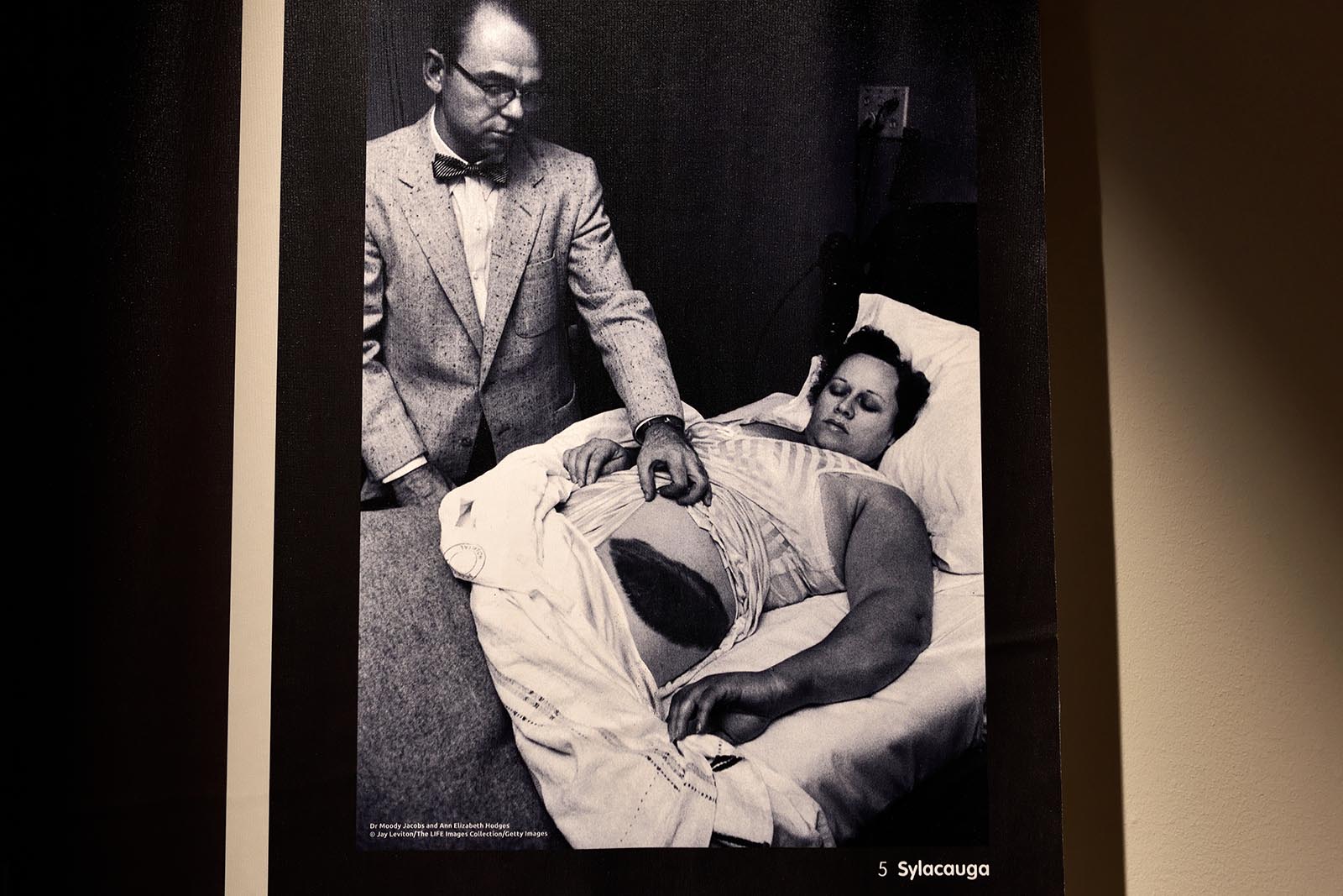 Forbrændt af en meteorit: Ann Elizabeth Hodges i sengen. Oprindeligt foto af Jay Leviton.