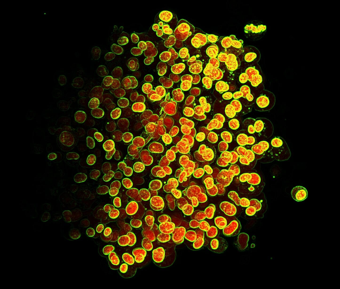 ’Brain tumor in a jar’. Billedet viser en lille klump kræftceller, som forskerne Kristoffer Laugesen og Liselotte Jauffred fra Niels Bohr Institutet har groet, så de ligner en kugleformet tumor. Cellekernerne er farvet røde, og de yderste grønne ringe viser overflade-membranerne. Billedet er taget med en såkaldt ’light-sheet’-mikroskopiteknik, der kan bruges til at lave 3D-modeller af væksten af hjernetumorer og bestemme, hvordan de enkelte cellers geometriske placering påvirker deres form og evne til at invadere det omkringliggende væv. Vinder i kategori ’Mikro'.