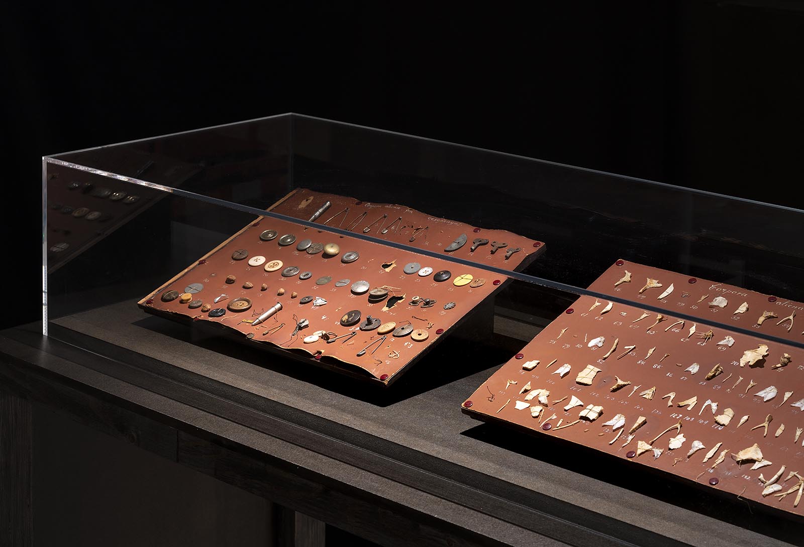 Plates of foreign bodies, værk fra midten af det 20. århundrede.