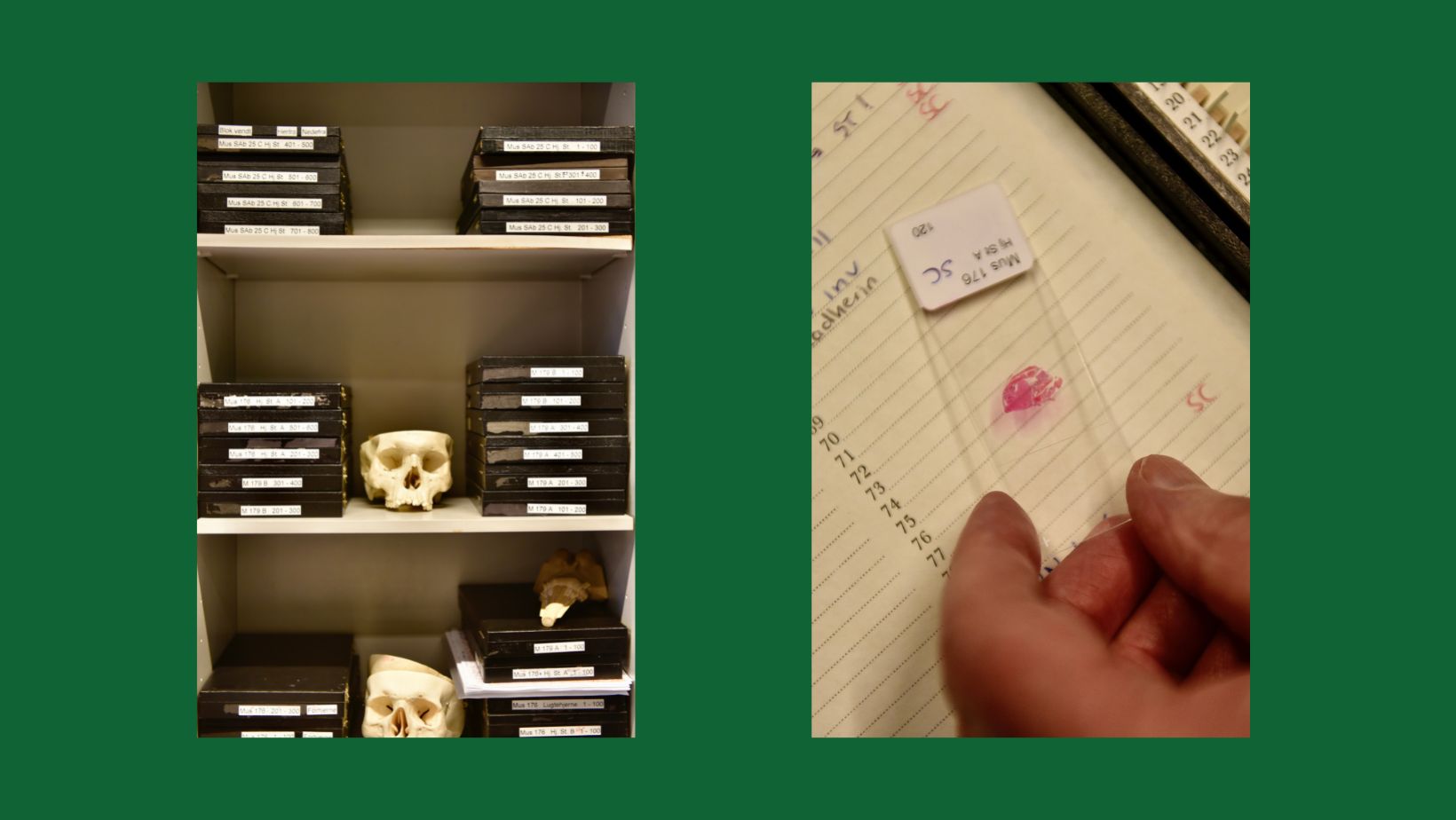 På Kjeld Møllgårds kontor står stakke af sorte kasser med hjerner fra mus og får. Når man åbner kasserne, ligger skiver af hjerner på rad og række. Det er dem, han ser på i mikroskopet.