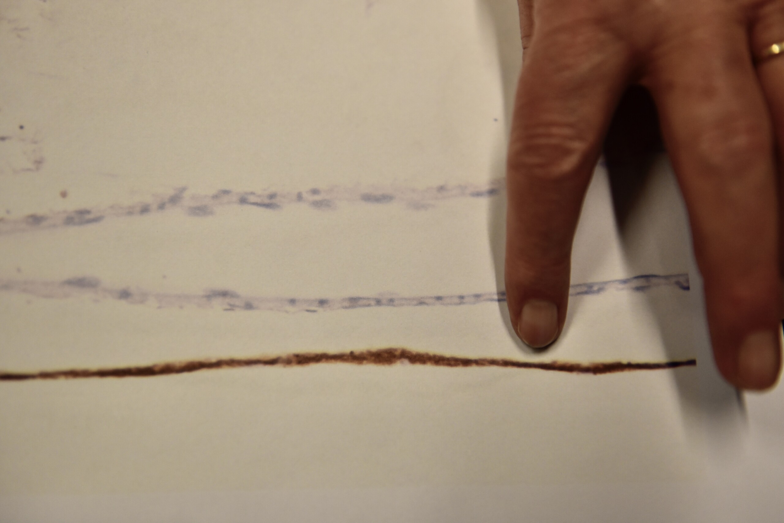 Da Kjeld Møllgård kiggede i mikroskopet, lignede hjernehinden først en brun streg.