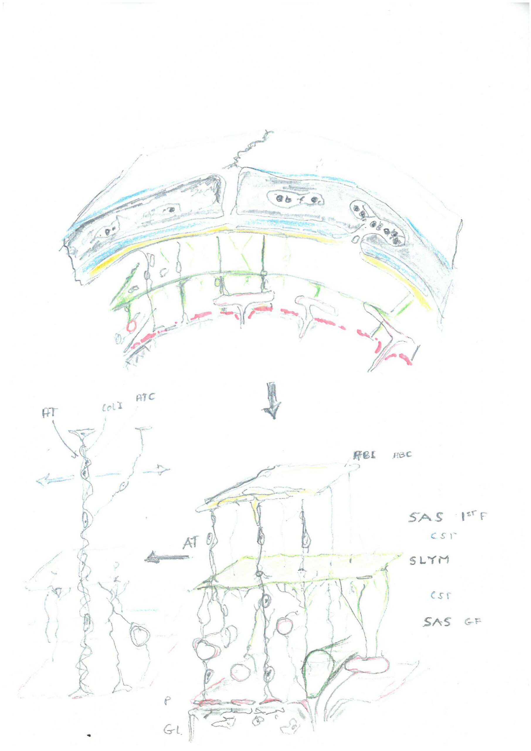 Tegningen, Kjeld Møllgård lavede med børnebørnene, er et godt bevis på, at han har fundet en ekstra hjernehinde, mener han. På den øverste tegning ses den nye hjernehinde tegnet med grøn.