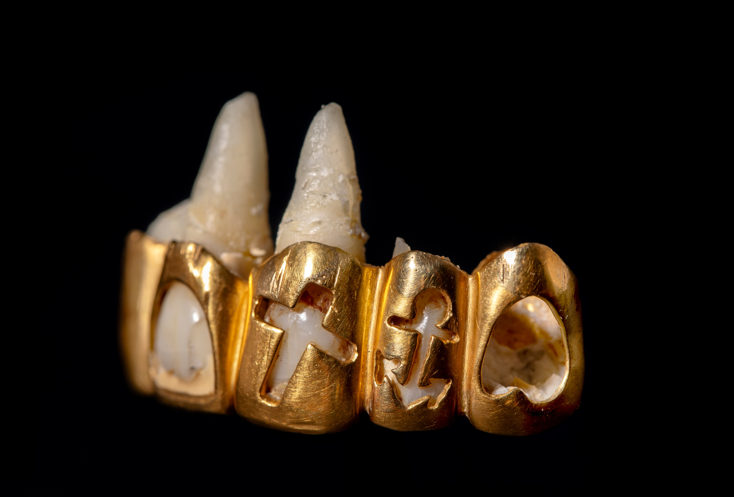 Tænderne har altid været et statussymbol og identitetsmarkør for mennesker. I samlingen findes disse guldtænder udsmykket med symbolerne for tro, håb og kærlighed.