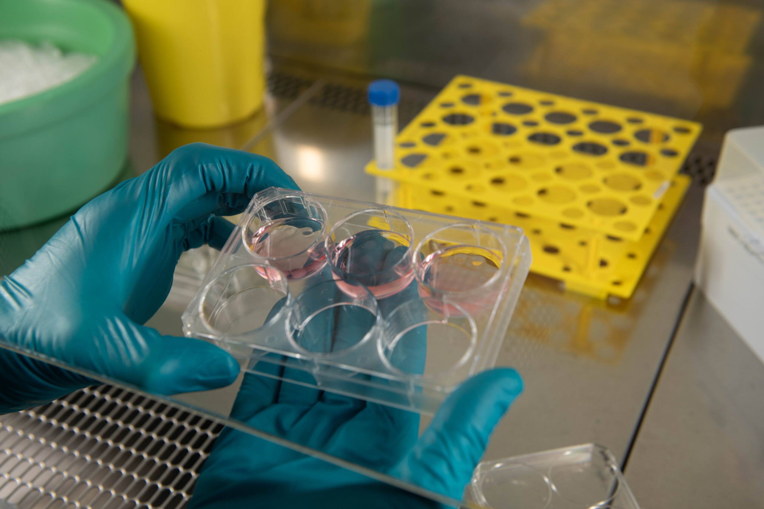 Et trænet øje kan se omridset af en hvid cellemasse – her befinder sig en kræfttumor.